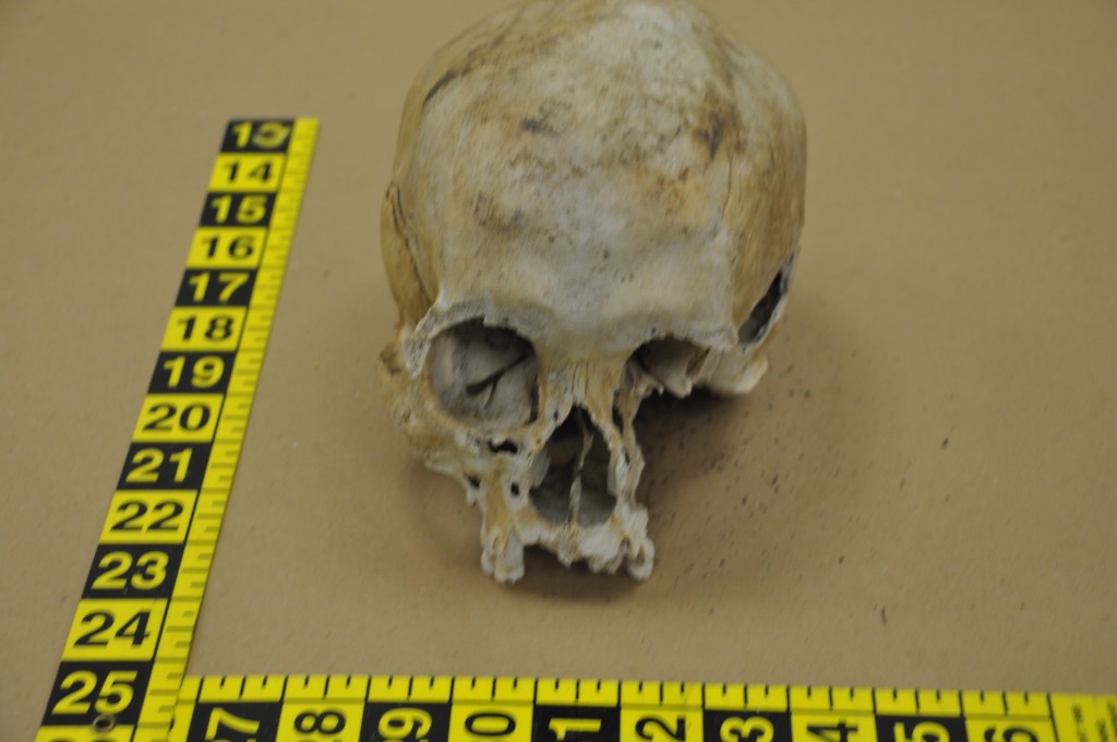 A human skull found in Brick. (File Photo)