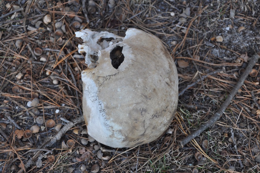 A human skull found in Brick. (File Photo)
