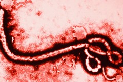 The Ebola virus. (File Photo/CDC)